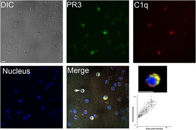 Proteinase 3 Interferes With C1q-Mediated Clearance of Apoptotic Cells